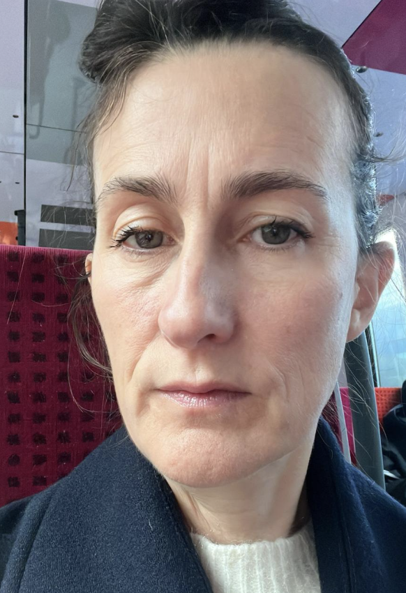 Mélanie après traitement