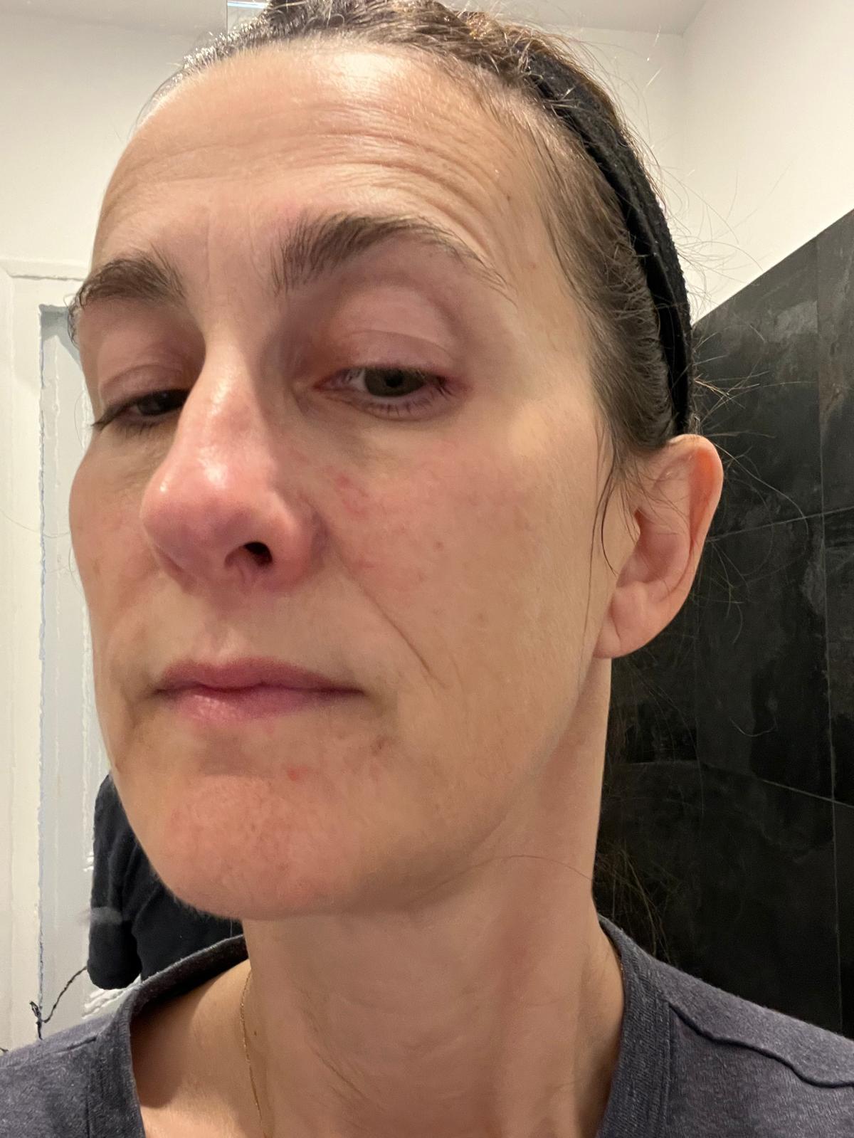 Marie avant traitement