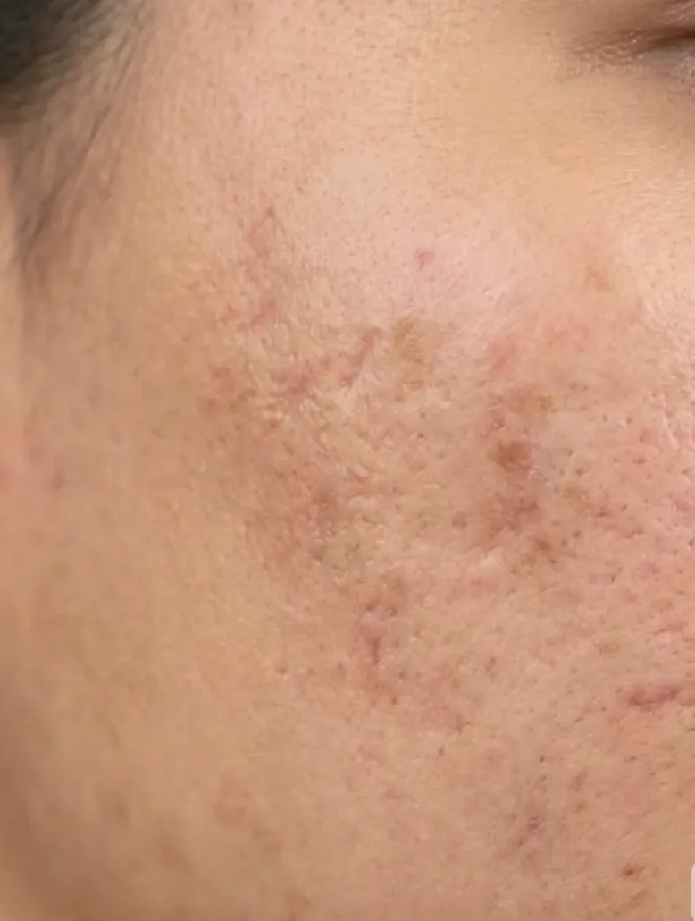 Exemple réel — photo zoomée